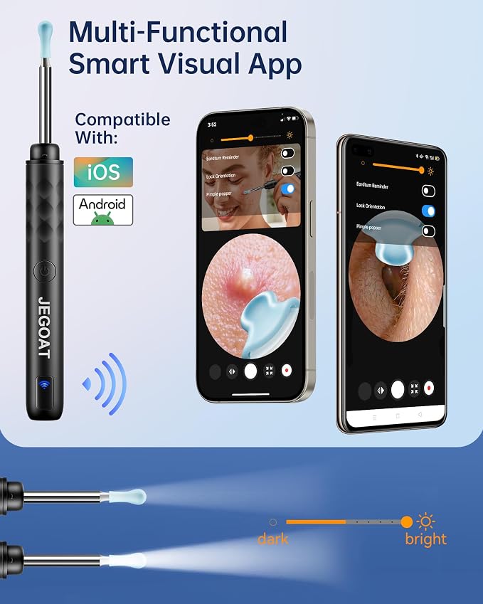 Jegoat Ear Wax Removal, Ear Wax Removal Tool Camera with 1296P HD Camera and 6 LED Lights, Ear Cleaner with 10 Ear Pick, Upgraded Ear Wax Removal Kit for iOS and Android, Glossy Black