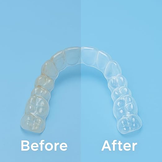 iSonic White CSDW01 Denture/Retainer Cleaning Crystal to Remove Stains, Buildups for all dental/sleep apnea/clear appliances, 8OZ bottle