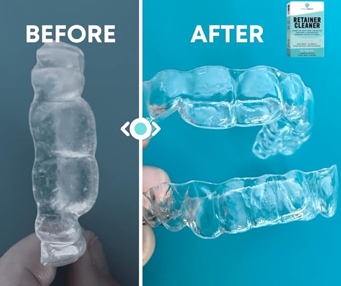FRESH KNIGHT Retainer Cleaner Tablets 120 - Invisalign Cleaner - Denture Cleaner. Efferdent Retainer Cleaner Tablets, Night Guard, Mouth Guards, Aligners & Dental Appliance Cleaner - 4 Month Supply.