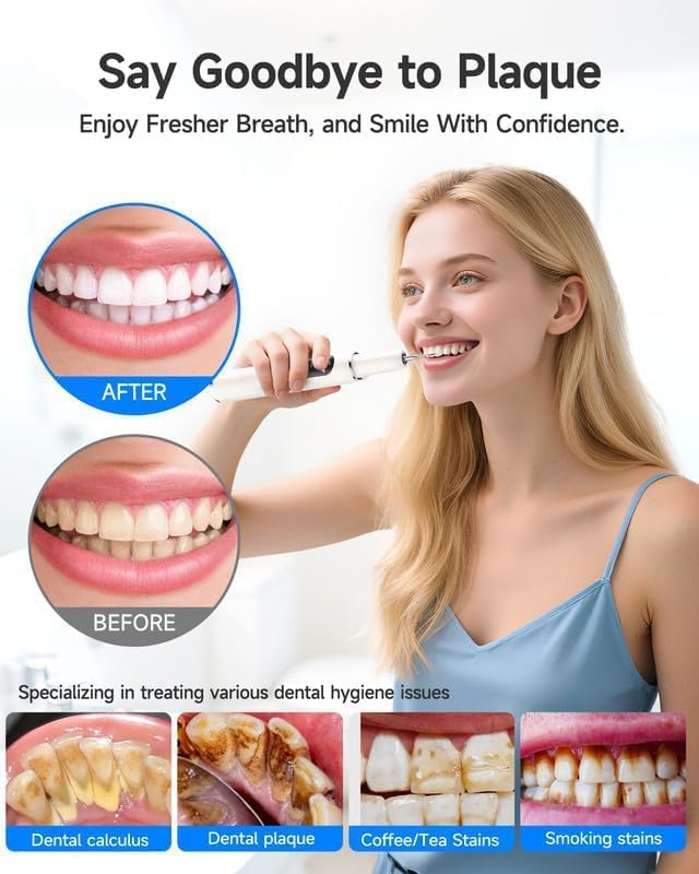 RELACS 7000 Plaque Remover for Teeth, Tartar Remover for Teeth, Dental Calculus Remover, Teeth Cleaning Kit 5 Speed Modes with 3 Replaceable Heads, with LED Light.