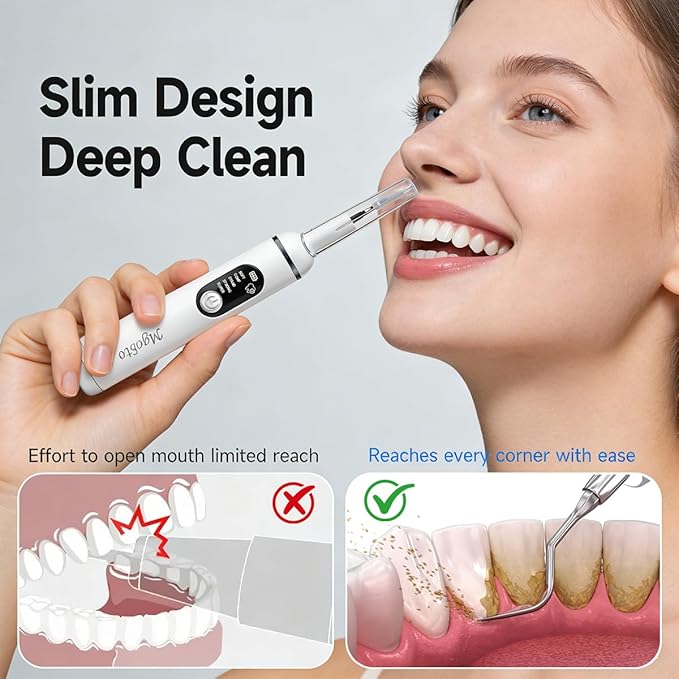 Ultimate Electric Teeth Cleaner - Ultrasonic Tooth Cleaning, Violet Light Protection, 316F Stainless Steel Heads, 5-Speed Modes, IPX6 Waterproof, Oral Care Kit with 11 Accessories‌ (White)