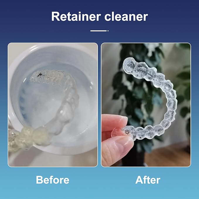 Retainer Cleaner Tablets for Invisalign, Mouth Guard Cleaner, Dissolve Stains, Odors and Plaque Dental Retainers for Aligner - Night Guards - False Teeth Whitening (60 pcs)