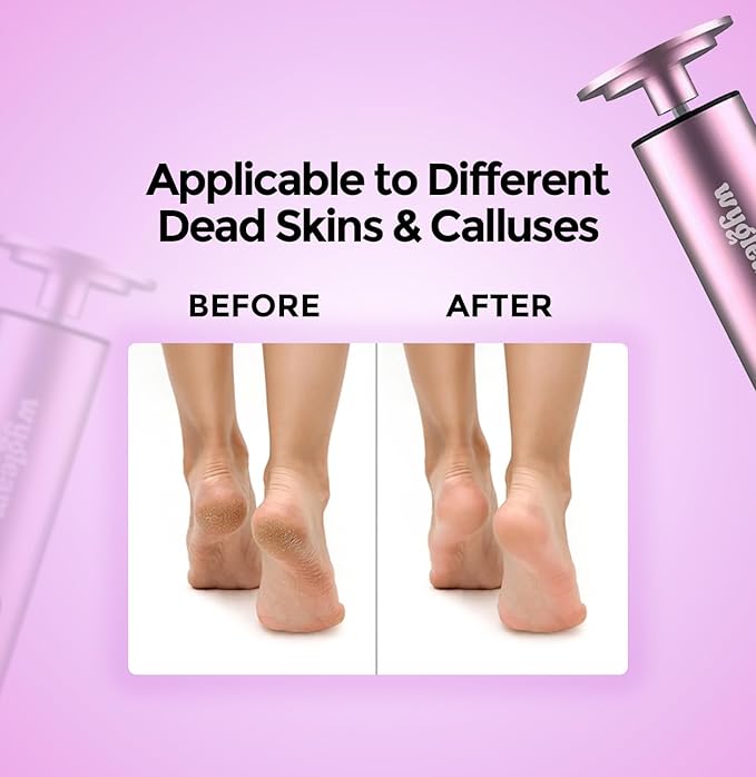 Electric Callus Remover for Feet & Nail File Drill Kit - 2 in 1 Rechargeable Pedicure Tools for Flawless Feet - Professional Foot File with 3 Speeds for Dead Skin Removal - At Home Pedicure