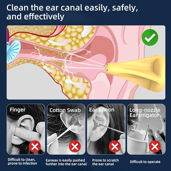 Smart Electric Ear Cleaner,Earwax Removal kit with IPX7 Waterproof Rating,Soft and Safe Effective Ear Wax Removal Tool.