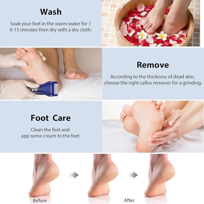 AdamPark Electric Callus Remover for Feet, Rechargeable Portable Electronic Foot Callus Remover 2-in-1 Wet/Dry Foot Scrubber Electric Toot File for Hard Cracked Dry Dead Skin（Blue）