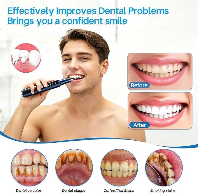 T9 Ultimate Electric Teeth Cleaner - Ultrasonic Tooth Cleaning, Violet Light Protection, 316F Stainless Steel Heads, 5-Speed Modes, IPX6 Waterproof, Oral Care Kit with 7 Accessories‌ (Blue)