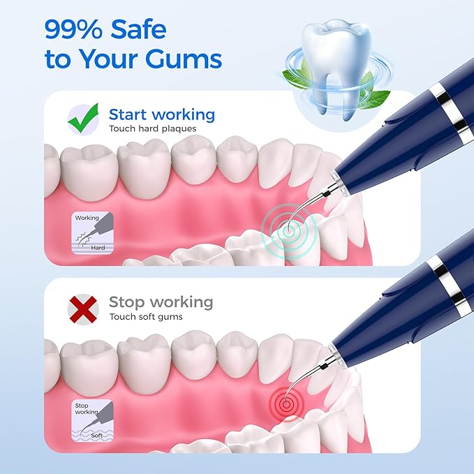 Plaque Remover for Teeth - Tartar Remover for Teeth, Dental Calculus Remover Teeth Cleaning Kit