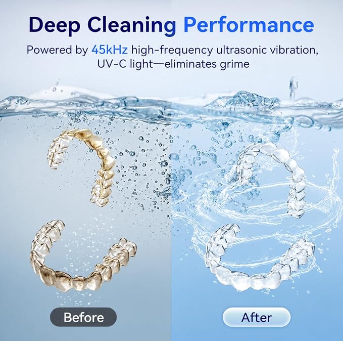 Ultrasonic Retainer Cleaner Machine, 45kHz Dental Cleaning Pod with 200ML Capacity, Deep Cleaning for Dentures, Aligners, Mouth Guards, Night Guards, Toothbrush, Braces & Jewelry | Ultrasonic Deep Cleaning With UV Lamp