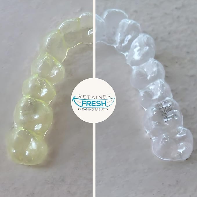Retainer Cleaning Kit & Tablets - 36 Tablets 1 Month Supply Retainer Fresh, Brite, and Stain-Free - Retainer Cleaner Tablet, Mouth Guard, Dentures, Aligners