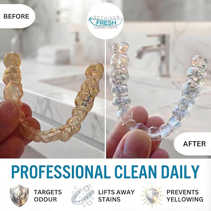Retainer Fresh Retainer Cleaner Tablets - Denture Cleaner, Retainer Cleaning Tablets, Mouth Guard Cleaner, Aligner Cleaner, Brite Retainer Tablets 120 Tablets 4 Month