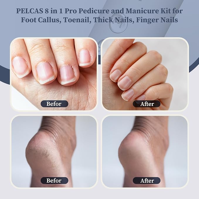 PELCAS 8 in 1 Electric Nail Filer with LED Light, Cordless Nail Drill, 5 Speeds Toenail Grinder for Thick Toenails, Manicure & Pedicure Kit for Foot Callus, Toenail, Thick Nails, Finger Nails Silver