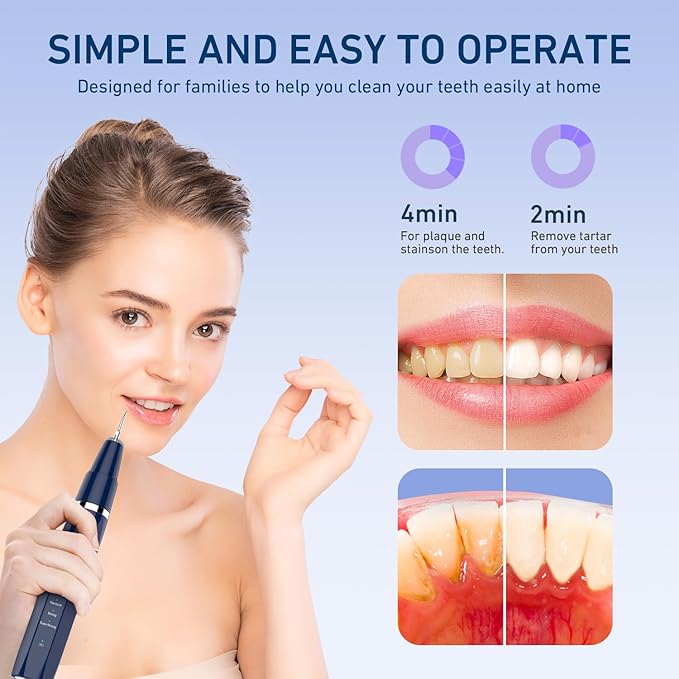 Plaque/Tartar Remover for Teeth, Dental Calculus Remover Teeth Cleaning Kit with LED Light & 5 Adjustable Modes