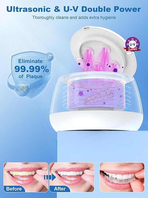 KUNPHY Ultrasonic Retainer Cleaner Machine, 48kHz Dental Cleaning Pod for Braces, Night Guard, Mouthguard, Toothbrush, Denture, Jewelry White
