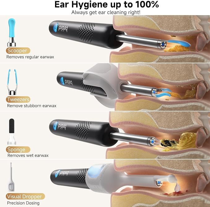 BEBIRD R1 Ultra Ear Wax Remova, Ear Cleaner with Camera Ear Scope, Wax Remove Ear Pick with Ear Otoscope Tweezers, Visual Dropper Cleaning Kit, Ear/Nose/Throat Examination Tool for Family, Black