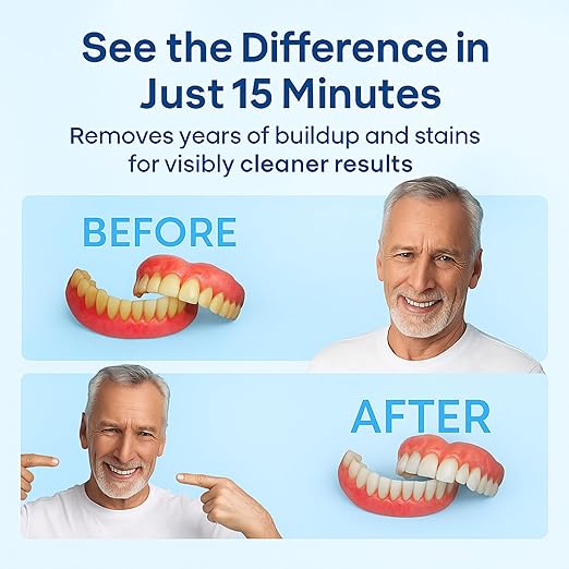 iSonic F3900 Ultrasonic Denture/Aligner/Retainer Cleaner for All Dental appliances (Machine Only)
