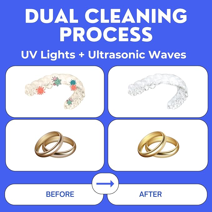 Ultrasonic Retainer Cleaner, UV Cleaner for Invisalign, Night Guard, Mouth Guard, Jewelry - Retainer Cleaning Machine