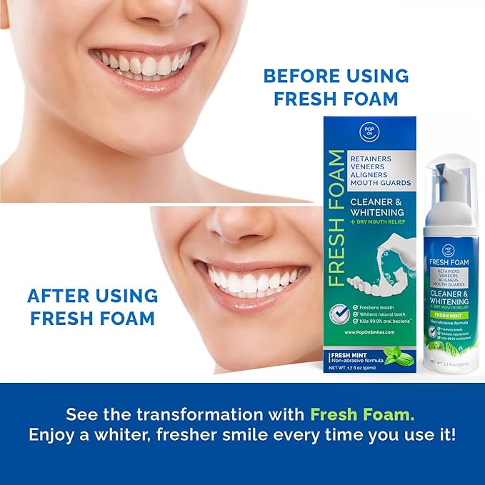 Aligner & Retainer Cleaner Fresh Foam | Retainer Cleaner Tablets for Invisalign FSA HSA Approved for Ultrasonic Cleaners 8-Month Supply | Bundle