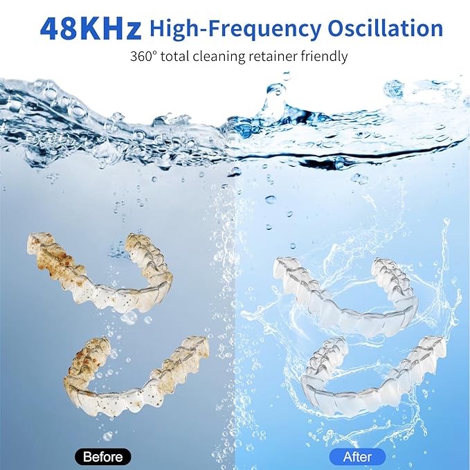 Ultrasonic Retainer Cleaner Machine 48 kHz Denture Cleaner 200ml Dental Cleaner Pod for Aligner Retainer, Jewelry, Night Guard, Brace, White