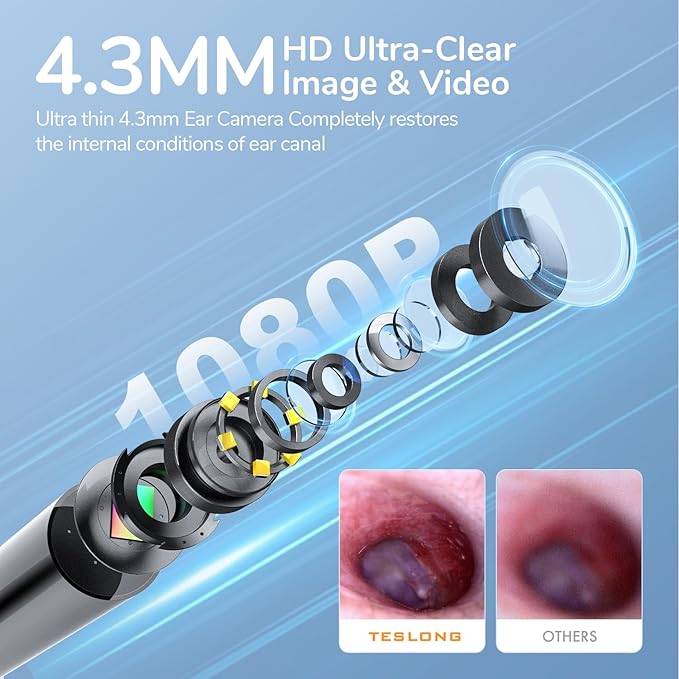 Teslong Digital Otoscope with Light, 1080p HD Ear Camera with Ear Wax Removal Tools, Video Ear Scope Otoscope with Light, Compatible with iPhone15, iPad, Android Phone, USB, Ear Picks, Waterproof
