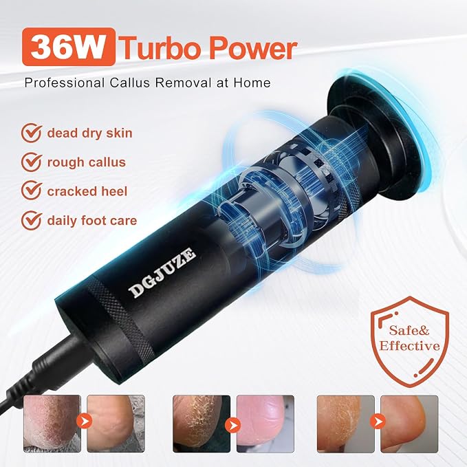 Electric Foot Callus Remover 36W, 1200RPM Heavy Duty Metal Grinder | 36W Motor, 60PCS Sandpaper Discs, Metal Body, Plug-in Corded, for Cracked Heels & Calluses, Home & Salon Pedicure Tool