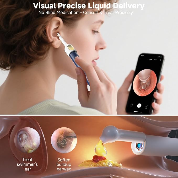 BEBIRD R1 Ultra Ear Wax Removal, Ear Cleaner with Camera, Wax Remove Ear Pick with Ear Tweezers, Visual Dropper Cleaning Kit, Ear/Nose/Throat Tool for Family, Blue