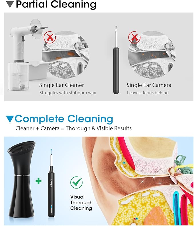 Ear Wax Removal Kit with Camera – Ear Cleaner Tool for Safe & Effective Ear Care – Includes Ear Camera for Visual Inspection & Gentle Ear Irrigation System – Complete Ear Cleaning Solution
