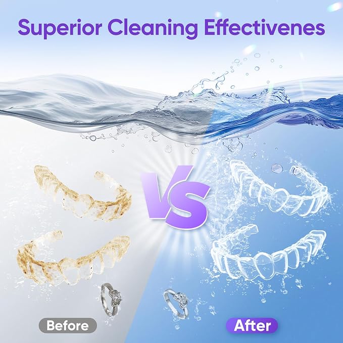 Ultrasonic Retainer Cleaner Machine, 45kHz Retainer Cleaner Machine for Denture Cleaner, 200ML Cleaner Ultrasonic Cleaner for Mouth Guard Cleaner,Night guard, Braces,Rings, Necklaces,White