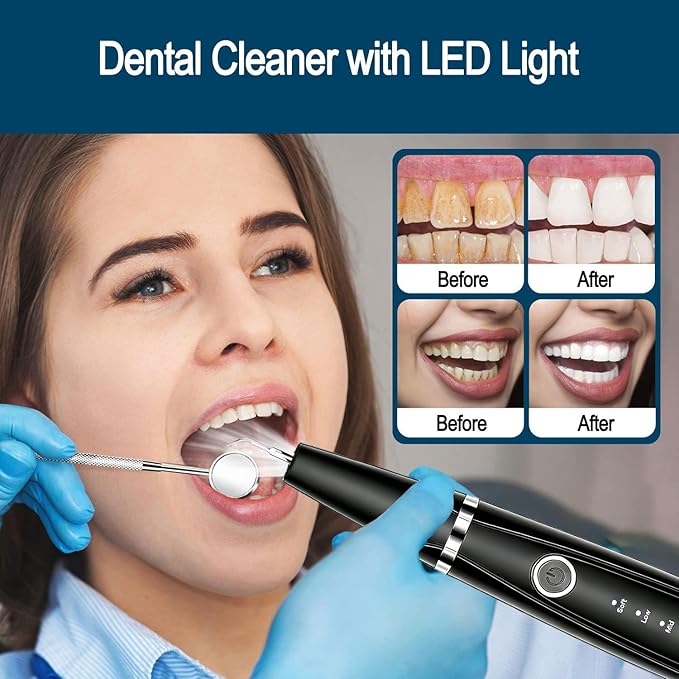 Sonic Electric Toothbrush, Dental Cleaner with LED Light, 5 Modes Teeth Cleaning Tool, 3 Replaceable Heads for Home & Travel, IPX6 Waterproof