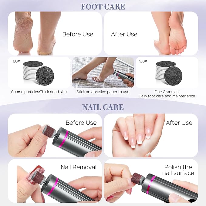 Electric Foot Callus Remover, 2 in 1 Callus Remover for Feet, 9 Adjustable Speeds with Sandpaper Disk and Nail Drill Bits, Digital Display, Rechargeable Pedicure Tools for Dead Skin(Gray)