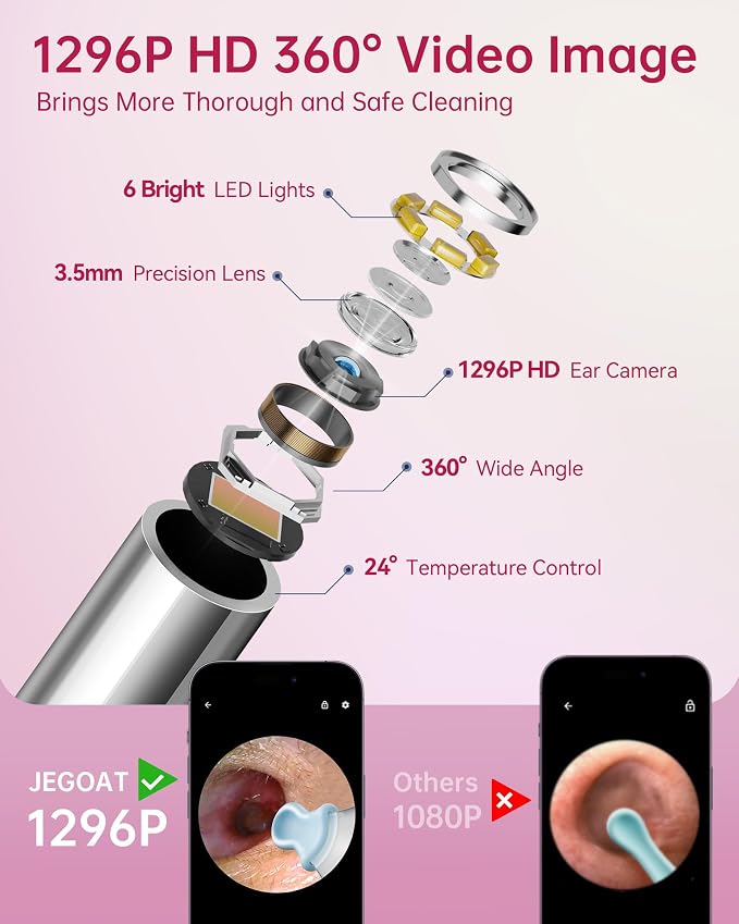 Jegoat Ear Wax Removal, Ear Wax Removal Tool Camera with 1296P HD Camera and 6 LED Lights, Ear Cleaner with 10 Ear Pick, Upgraded Ear Wax Removal Kit for iOS and Android, Pink