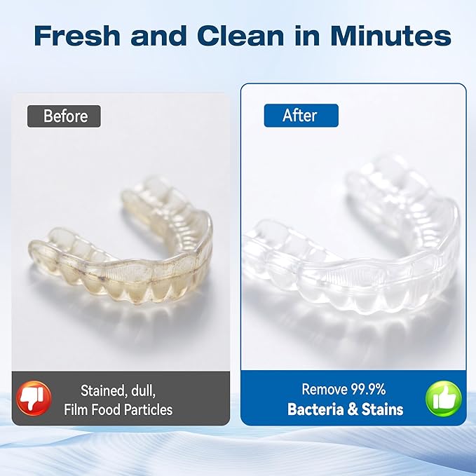 KUNPHY Dentures Cleaning Tablets for Dentures, Mouth Guards (Blue)
