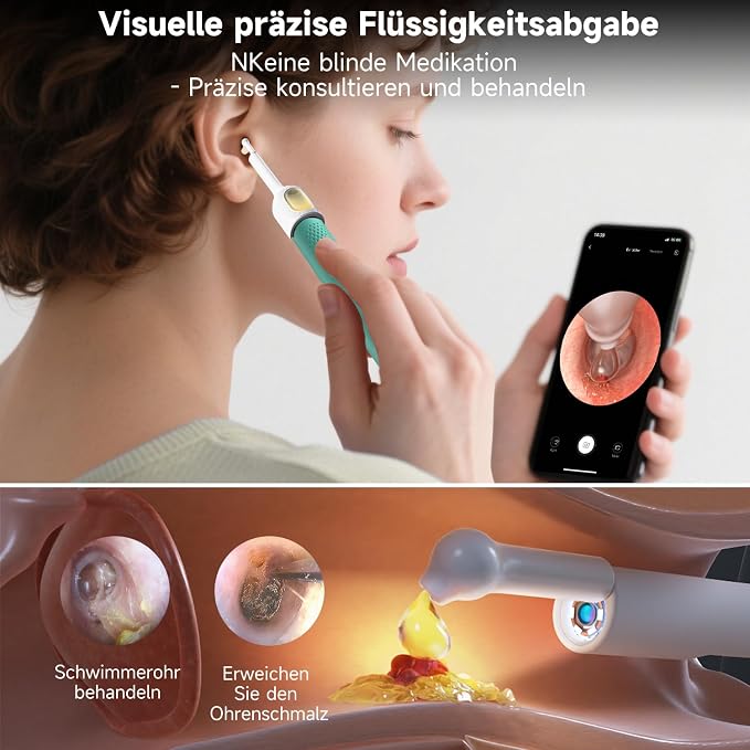BEBIRD R1 Ultra Ear Wax Removal, Ear Cleaner with Camera Ear Scope, Wax Remove Ear Pick with Ear Otoscope Tweezers, Visual Dropper Cleaning Kit, Ear/Nose/Throat Examination Tool for Family, Green