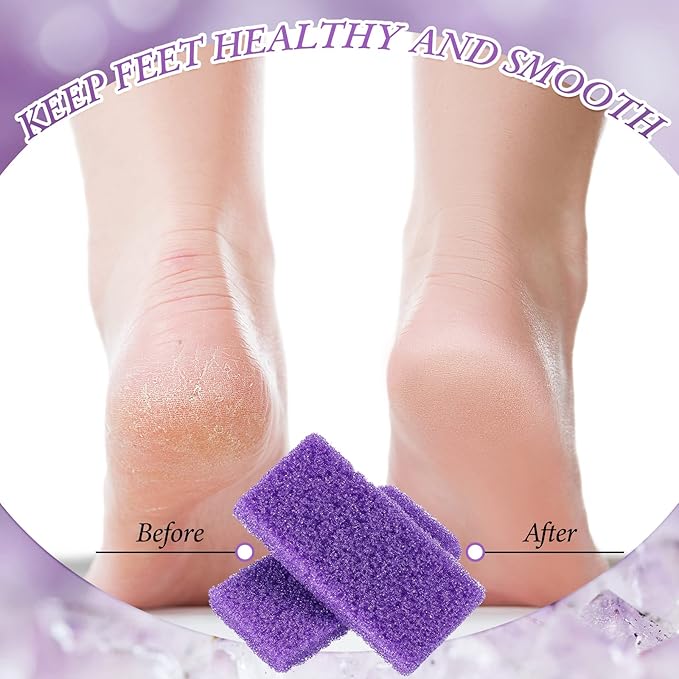 Dunzy 200 Pcs Disposable Pumice Stones for Feet, Professional Pedicure Callus Remover Blocks for Spa Salon Pedicure Supplies, Foot Exfoliating Scrubber for Dead Skin and Heel Care