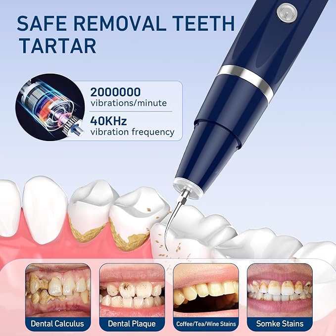 Plaque/Tartar Remover for Teeth, Dental Calculus Remover Teeth Cleaning Kit with LED Light & 5 Adjustable Modes