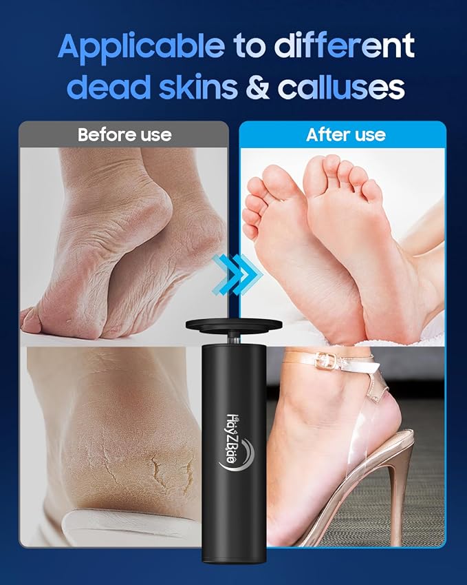 HayZBao Electric Callus Remover for Feet | FSA&HSA Eligible 12V High Power Plug-in Electric Foot Callus Remover with 60 Pcs Sanding Discs