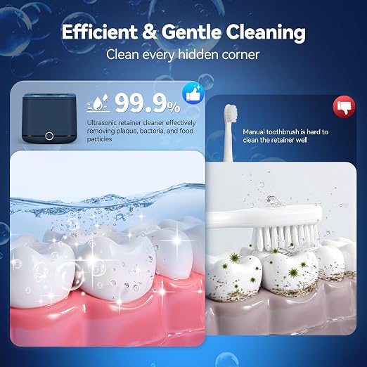 Miorcols Retainer Cleaner, 48kHz Ultrasonic Retainer Cleaner Machine for Denture, Mouthguard, Braces, Night Guard, Aligner, Toothbrush, Jewelry with 7.8OZ Dental Cleaning Pod-Blue