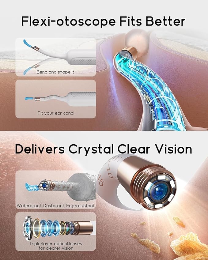 Bebird Earsight Plus R37R Ear Wax Removal Tool Camera, FSA HSA Eligible Items, Smart Ear Cleaner with Painless Visual Tweezers, Flexible Ear Camera Otoscope, Home ENT Cleaning Kit for Family,White