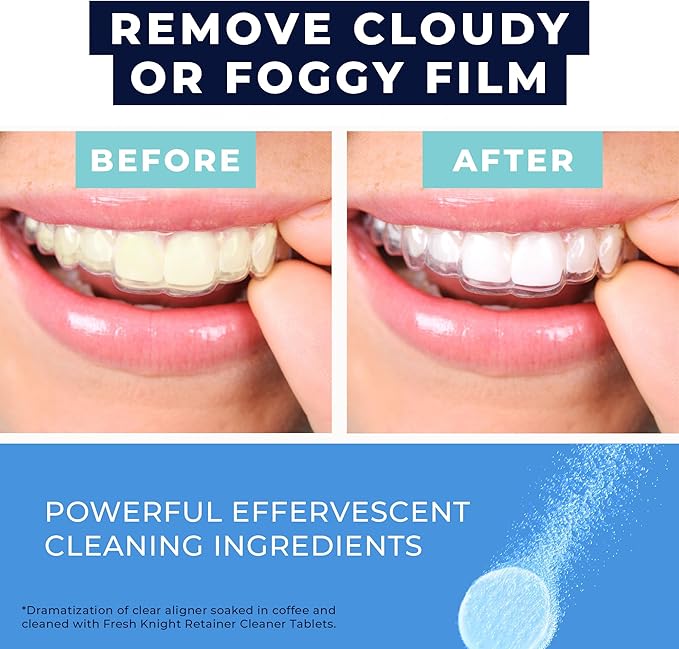 FRESH KNIGHT Retainer Cleaner Tablets 120 - Invisalign Cleaner - Denture Cleaner. Efferdent Retainer Cleaner Tablets, Night Guard, Mouth Guards, Aligners & Dental Appliance Cleaner - 4 Month Supply.