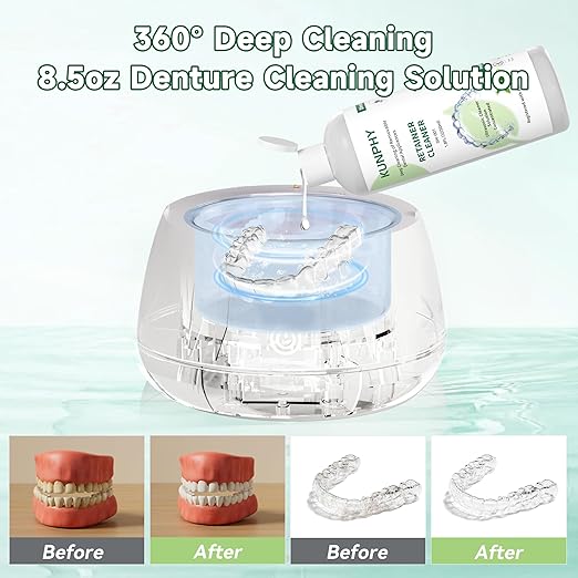 KUNPHY Ultrasonic Retainer Cleaner Solution Concentrate-Professional Cleaning of Retainers, Denture, Invisible Aligners, Mouth Guards, Night Guards, Remove Odors, Discoloration & Stains 1.8 oz(Mint)