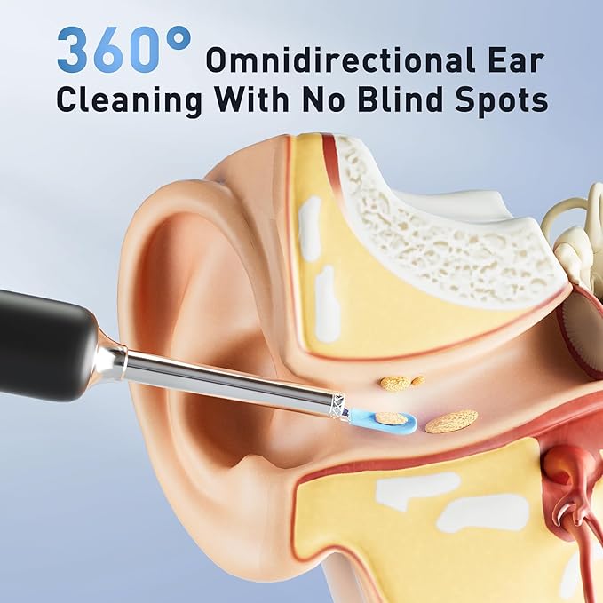 Lebbtl Ear Wax Removal - Electric Ear Irrigation Flushing System, Ear Cleaner with Camera, 1080P Otoscope, Ear Cleaning Tool with 7 Pcs Ear Set, Safe and Effective Earwax Removal Kit