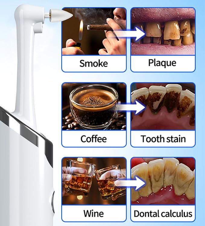 Tooth Polisher Kit with 5 Speed Modes and 5 Heads,Tooth Whitening for Cleaning with Led Light, IPX7 Waterproof Tooth Polish Complete Teeth Cleaning Tools Home Dental Care Set White
