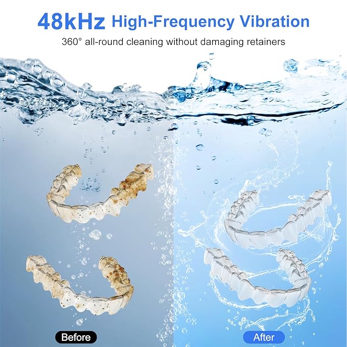 Ultrasonic Retainer Cleaner Machine 48 kHz Denture Cleaner 200ml Dental Cleaner Pod for Aligner Retainer, Jewelry, Night Guard, Brace, Black