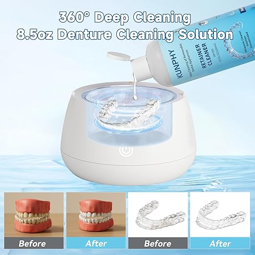 Ultrasonic Retainer Cleaner Solution for Ultrasonic Denture Cleaner-Professional Cleaning of Retainers, Invisible Aligners, Mouth Guards, Night Guards, Remove Odors, Discoloration & Stains 8.5oz