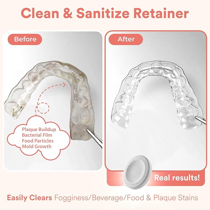 Weiss Naturals Retainer Cleaning Tablets, Invisalign Cleaner, Remove Stains, Odors & Plaque, FSA & HSA Eligible, Night Guard Cleaner PERSULFATE & DYE-FREE 1-Month Supply, Denture Cleaners, 30 Tablets