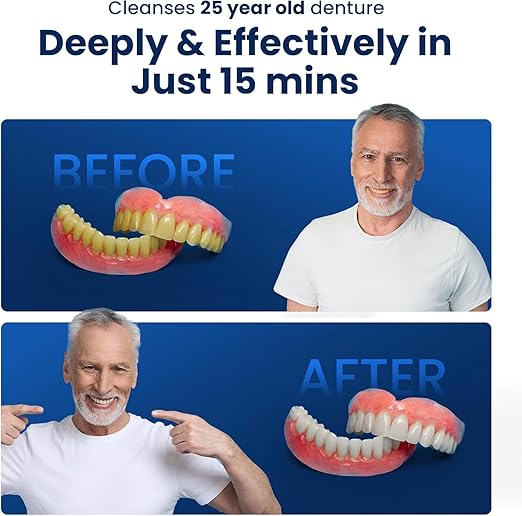 iSonic F3900 Ultrasonic Denture/Aligner/Retainer Cleaner for All Dental appliances with 1 Box of AlignerClean CTAR01 Ultrasonic Cleaning Tablet