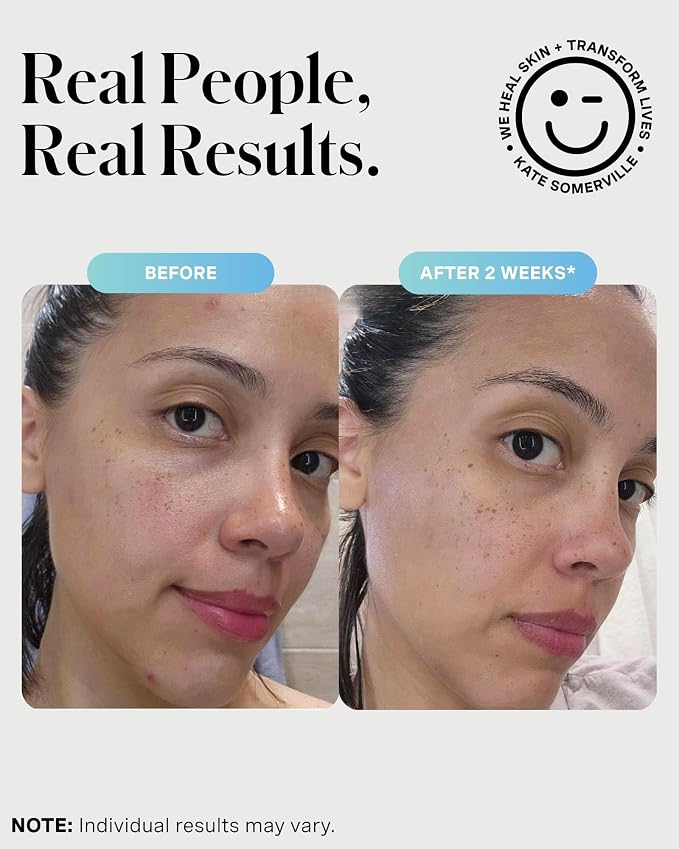 Kate Somerville EradiKate 3% Sulfur Daily Foaming Cleanser Acne Treatment – Clinically Formulated Medicated Face Wash Balances Skin & Cleans Pores, 4 Fl Oz