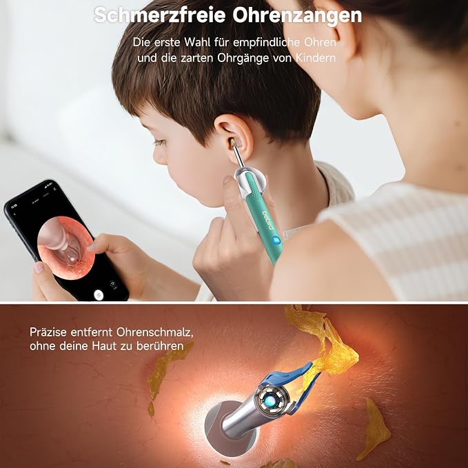 BEBIRD R1 Ultra Ear Wax Removal, Ear Cleaner with Camera Ear Scope, Wax Remove Ear Pick with Ear Otoscope Tweezers, Visual Dropper Cleaning Kit, Ear/Nose/Throat Examination Tool for Family, Green