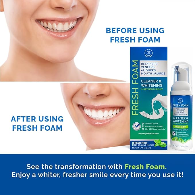 Aligner & Retainer Cleaner Foam – Dry Mouth Relief, Compatible with Invisalign, Aligners, Retainers, Mouth Guards, Night Guards, Veneers, Whitens, Freshens, 3% Hydrogen Peroxide, Mint - 50ml, 2 PC