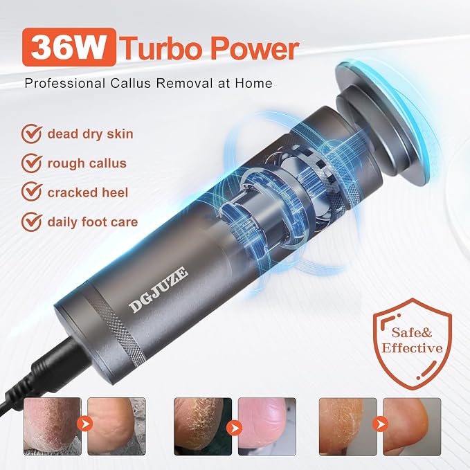 Electric Foot Callus Remover 36W, 1200RPM Heavy Duty Metal Grinder | 36W Motor, 60PCS Sandpaper Discs, Metal Body, Plug-in Corded, for Cracked Heels & Calluses, Home & Salon Pedicure Tool