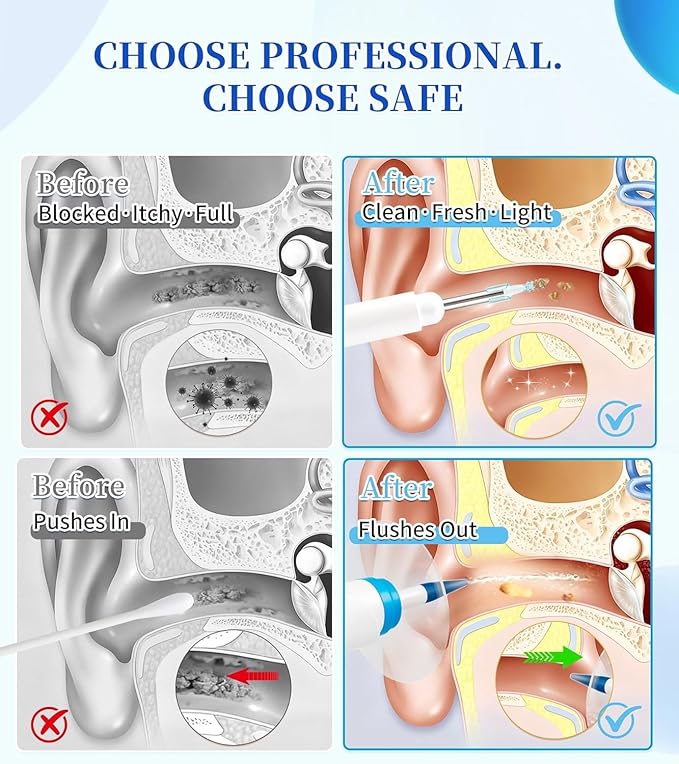Ear Wax Removal,Electric Ear Flush Kit for Safe Solo Use at Home,Ear Cleaning Tools with 4 Pressures Modes & LED Light, Includes Basin, Towel & 15 Tips